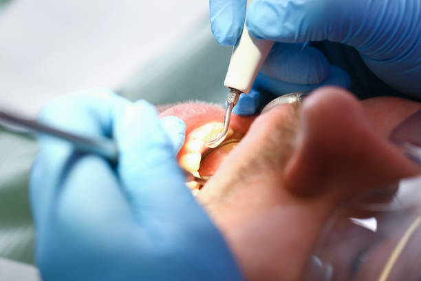 Best Urgent Tooth Repair  in Star Valley, AZ