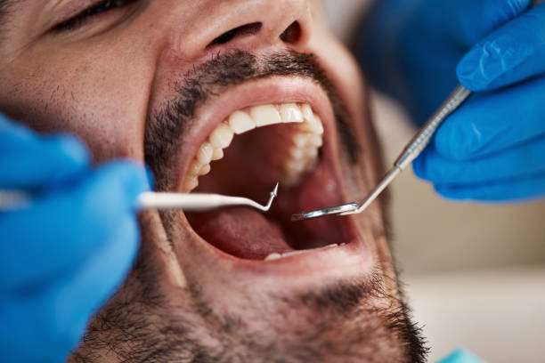 Best Urgent Tooth Repair  in Star Valley, AZ